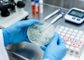 Uropathogens from diabetic patients show higher multidrug resistance than those from non-diabetics