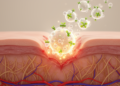 Plant Compound Ziyuglycoside I Speeds Wound Healing by Activating Immune Cells Through GPR34 Receptor