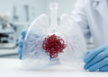 3D-Printed Lung Models Help Doctors Plug Dangerous Vessel Tangles