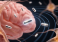 Magnetoelectric nanoparticles could sense brain magnetic fields, simulation study finds