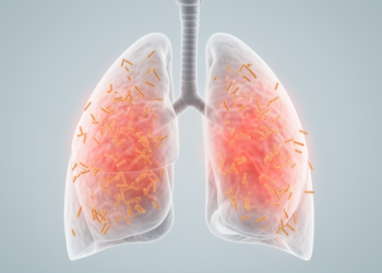 Fatal Pneumocystis pneumonia with rapidly progressive lung disease in anti-MDA5 dermatomyositis