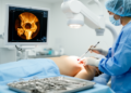 Microwave ablation of an acetabular tumor restores phosphate in osteomalacia case