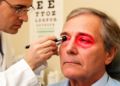Orbital inflammatory pseudotumor cases rose during COVID-19 Omicron wave