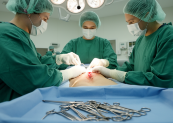 Elliptical Midline Excision With Rectangular Flap Shows Low Complications in Pilonidal Sinus Study