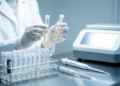 Serum and urine protein biomarkers may sharpen prostate cancer detection beyond PSA