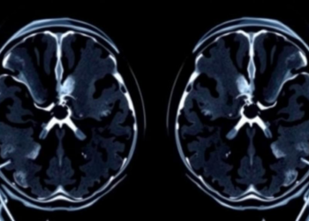 Sharper Prostate MRI Scans May Not Mean Better Cancer Detection, Review Finds