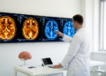 New AI Reads Brain Scans Four Ways to Spot Alzheimer's Stages and Know When It Is Unsure