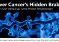 Liver Cancer's Hidden Brake: How A20 Marks a Key Tumor Protein for Destruction