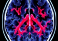 Hidden Aggression: Machine Learning Exposes Dangerous Biology in Low-Risk Prostate Cancer