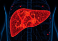 Single-cell atlas of human liver pinpoints scar macrophages as drug target for fibrosis