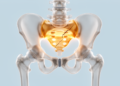 Rare Partial Triradiate Cartilage Injury Seen in Teen Athlete After Minor Trauma