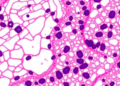 AI Reads the Endometrium: Foundation Models Predict IVF Success from Tissue Slides