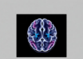 Brain Scans and Mitochondrial DNA Offer Clues to Maternal Alzheimer's Risk
