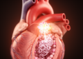 Heart Disease Genetics: Little-Known Chaperone Hero11 Emerges as Coronary Risk Gene