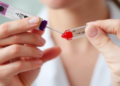 Blood Test Reads DNA Methylation Patterns to Help Detect Deadly Esophageal Cancer