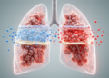 Why Oxygen Falls and Carbon Dioxide Rises in ARDS: The Bedside Physics of Failing Lungs