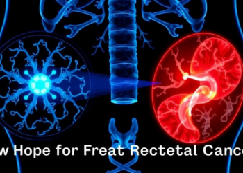 Radiotherapy Meets Immunotherapy: New Hope for Hard-to-Treat Rectal Cancer