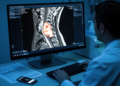 AI Reads the Neck's Deadliest Plaques, but the Clinic Isn't Ready Yet