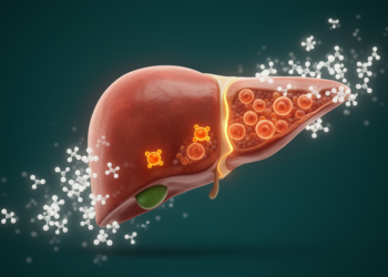 Stevia Extract Shields Diabetic Livers by Taming Iron-Driven Cell Death