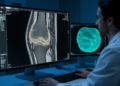 AI Learns to Map Knee Cartilage with Expert Precision on MRI Scans