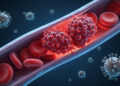 Rare Cold-Triggered Anemia Strikes After Shingles and COVID-19 in First Reported Case