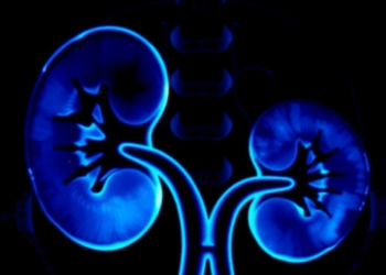 Ten-Year Data Show Image-Guided Tumor Ablation Cures Small Kidney Cancers Without a Scalpel