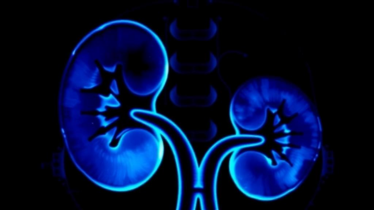 Ten-Year Data Show Image-Guided Tumor Ablation Cures Small Kidney Cancers Without a Scalpel