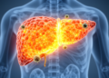 PET tracer lights up ferroptosis to track liver cancer immunotherapy in real time