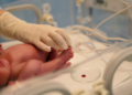 Blood Protein Fingerprints Could Reveal Hidden Sepsis in Preterm Babies