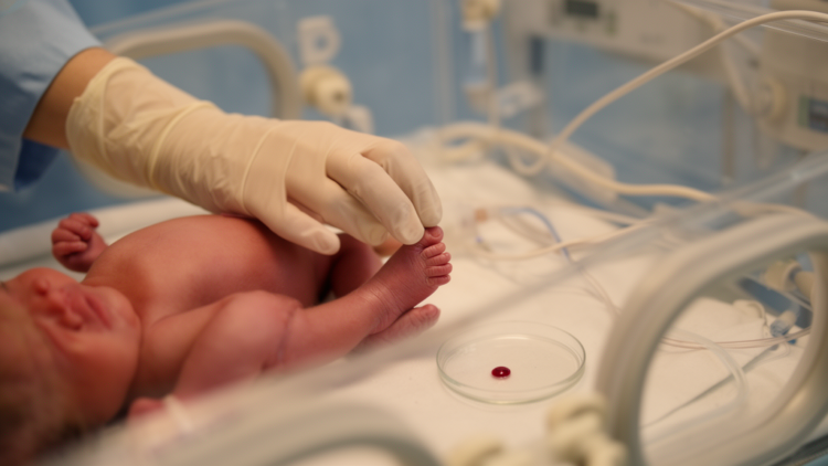 Blood Protein Fingerprints Could Reveal Hidden Sepsis in Preterm Babies