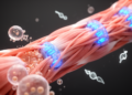 From Sodium Blockers to Gene Silencing: The Treatment Revolution in Myotonic Disorders