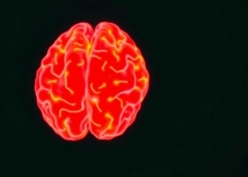 Seizures Before Surgery Linked to Sharper Processing Speed in Glioma Patients