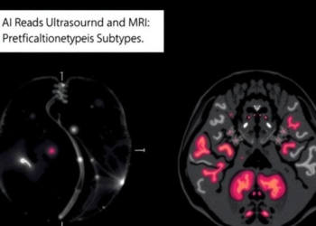 AI Reads Ultrasound and MRI Together to Predict Breast Cancer Subtypes Without a Biopsy