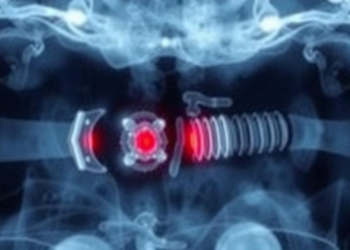 Ultrasound-Shaken Implants Reveal Hidden Bone Infection Pathogens