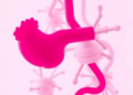 Pancreatic Cancer Burden Climbs in China and the US as Risk Factors Diverge