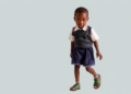 Corrective Surgery Restores Walking, Schooling and Dignity for Children in Rural Cameroon