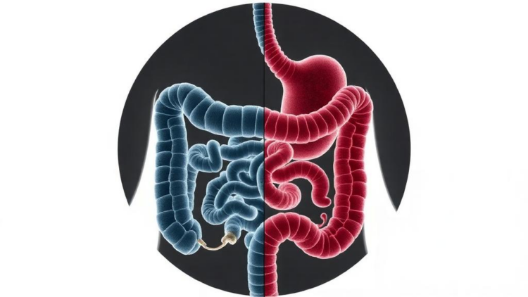 Two Gut Microbe Types Split IBD Patients Into Very Different Diseases