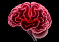 Shrinking Caudate and Reshaped Amygdala Linked to Anxiety in Early Parkinson's Disease