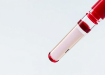 Simple Blood Test Shows Promise for Detecting Liver Fibrosis in Schistosomiasis