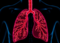 Low-Dose Dexamethasone Shows Promise for Premature Lungs, With Caveats