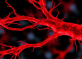 Overactive Inflammasome in Artery Muscle Cells Drives Dangerous Vessel Thickening in Mice