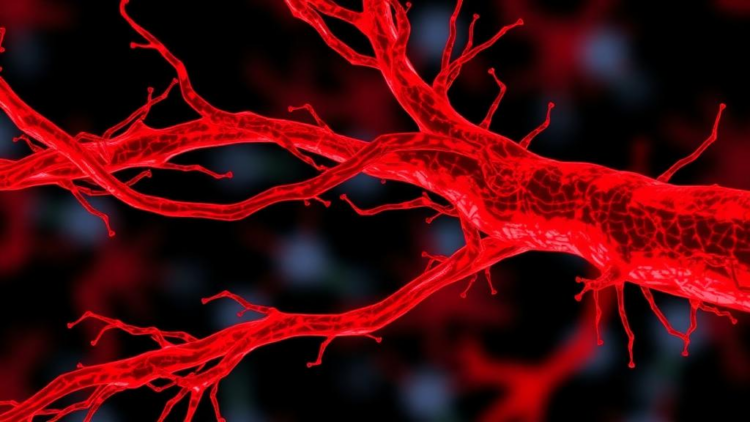 Overactive Inflammasome in Artery Muscle Cells Drives Dangerous Vessel Thickening in Mice