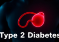 Hormone Balance May Shape Blood Clot Strength in Men With Type 2 Diabetes