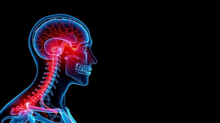 AI Reads Brain-Attack Risk Straight From Neck Artery Scans in Under a Second