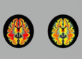 Evolution-Tuned AI Ensemble Reads Brain Tumor Scans With Near-Perfect Accuracy