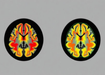 Evolution-Tuned AI Ensemble Reads Brain Tumor Scans With Near-Perfect Accuracy