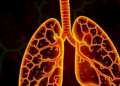 Endothelial Angptl2 Emerges as Central Driver of Influenza-Linked Lung Fibrosis