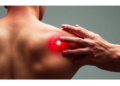 Electroacupuncture Shrinks Torn Shoulder Tendon in Striking Case Report