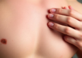 Itchy Skin Disease Linked to Higher Rates of Erectile Dysfunction in Large US Study