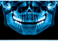 AI Reads Dental X-Rays With Anatomy Awareness to Spot Hidden Jawbone Infections